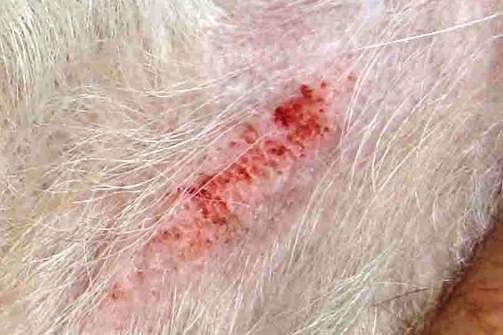 Ekcéma - Eczema
